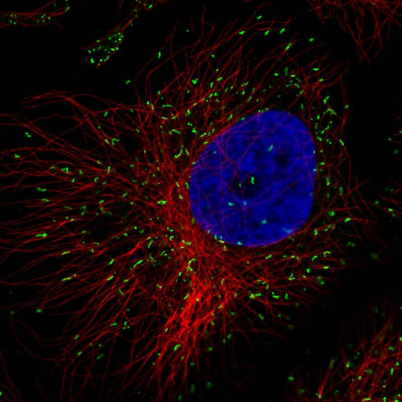 Immunocytochemistry/ Immunofluorescence: PMP70 Antibody (CL2524) [NBP3-52459]