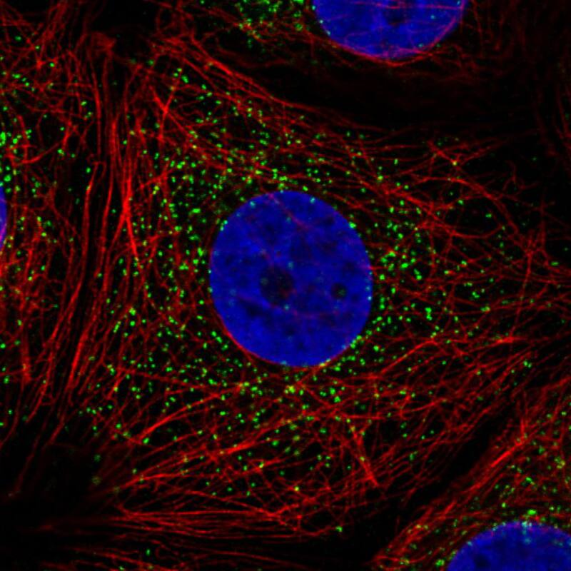 Immunocytochemistry/ Immunofluorescence: PMP70 Antibody (CL2524) [NBP3-52459]