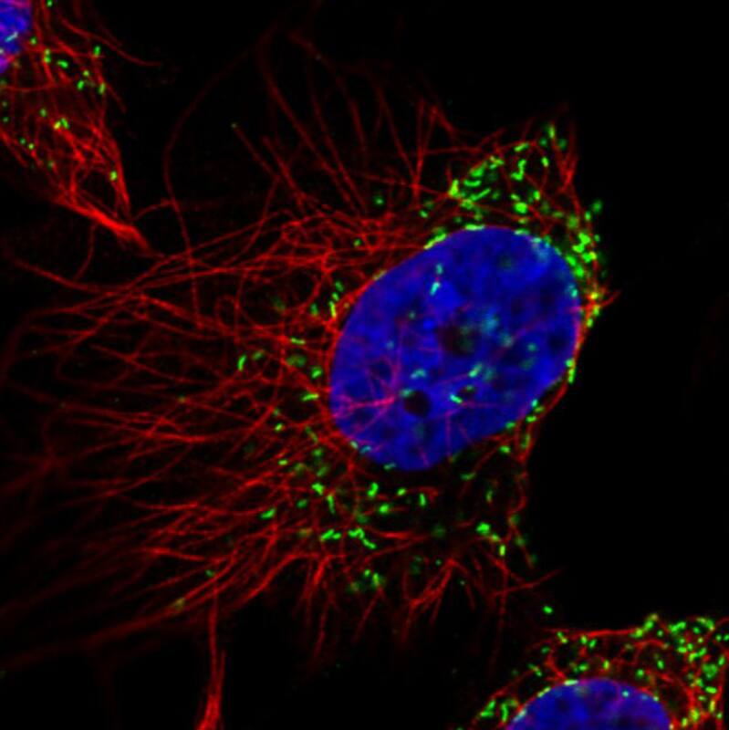 Immunocytochemistry/ Immunofluorescence: PMP70 Antibody (CL2524) [NBP3-52459]