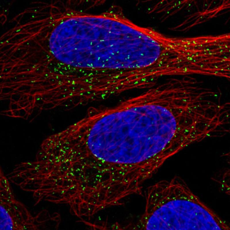 Immunocytochemistry/ Immunofluorescence: PMP70 Antibody (CL2524) [NBP3-52459]