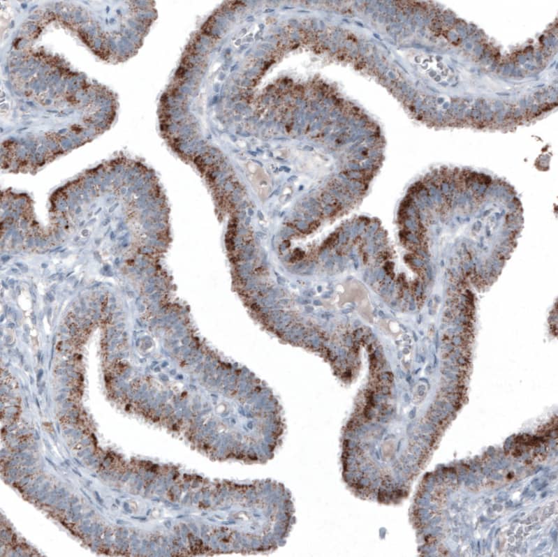 PMP70 Antibody (CL2524) Immunohistochemistry: PMP70 Antibody (CL2524) [NBP3-52459]