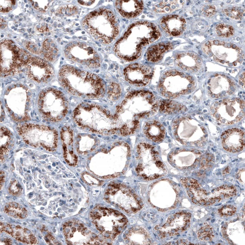 PMP70 Antibody (CL2524) Immunohistochemistry: PMP70 Antibody (CL2524) [NBP3-52459]
