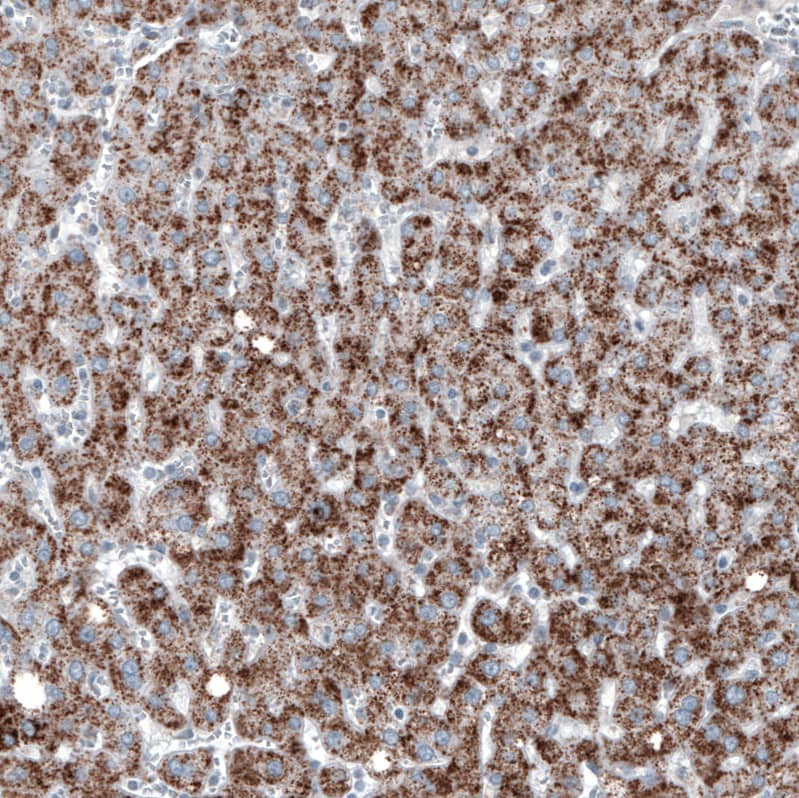 PMP70 Antibody (CL2524) Immunohistochemistry: PMP70 Antibody (CL2524) [NBP3-52459]