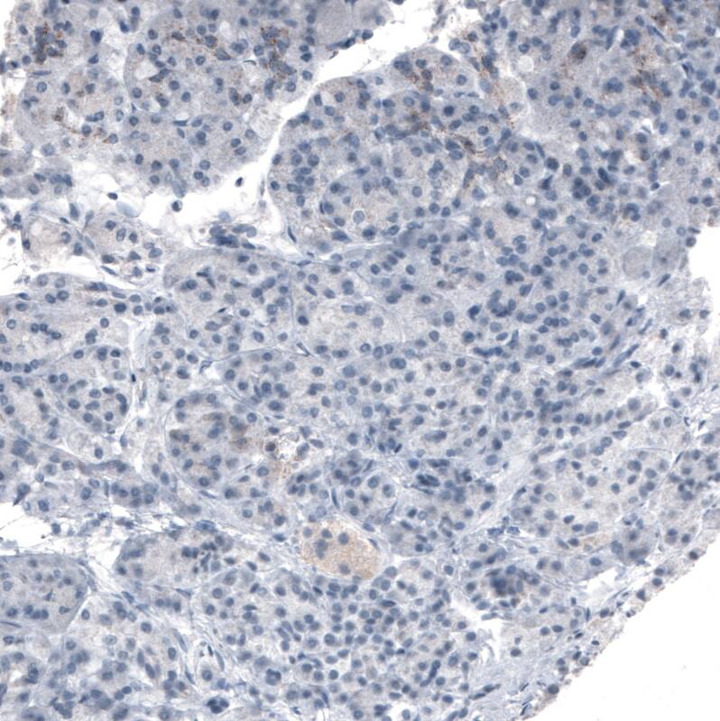 PMP70 Antibody (CL2524) Immunohistochemistry: PMP70 Antibody (CL2524) [NBP3-52459]