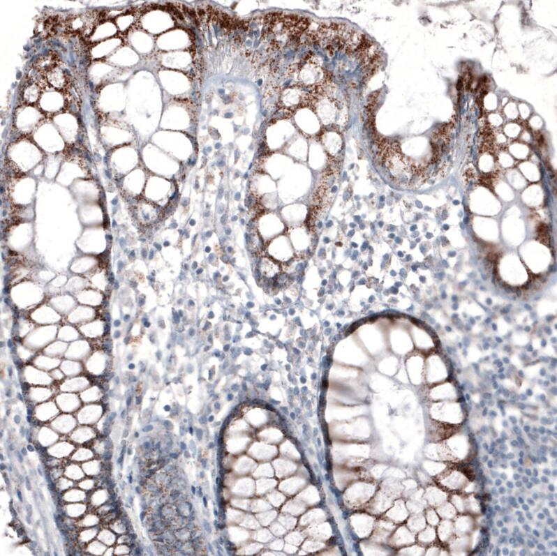 PMP70 Antibody (CL2524) Immunohistochemistry: PMP70 Antibody (CL2524) [NBP3-52459]