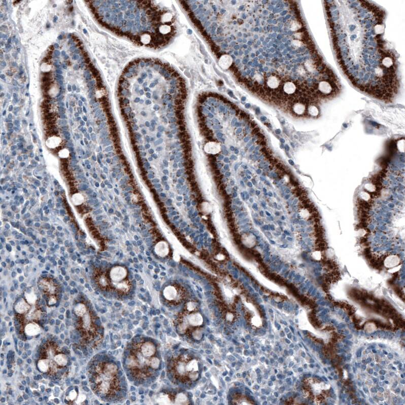 PMP70 Antibody (CL2524) Immunohistochemistry: PMP70 Antibody (CL2524) [NBP3-52459]