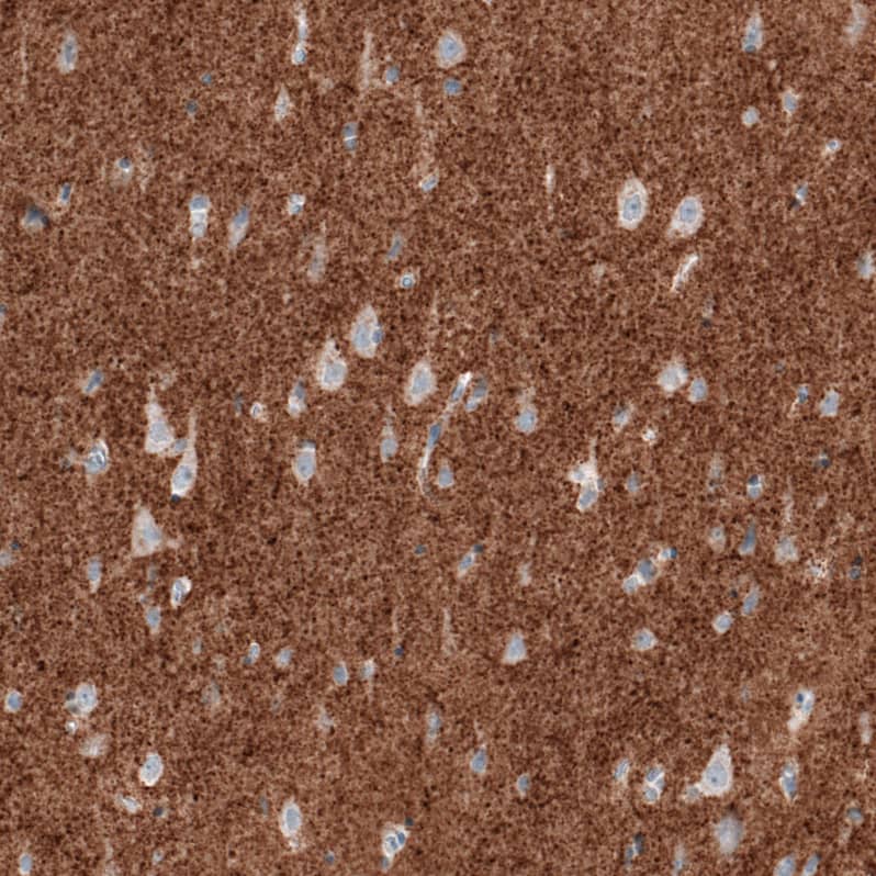 Immunohistochemistry-Paraffin: VGLUT2 Antibody (CL2921) [NBP3-52463]