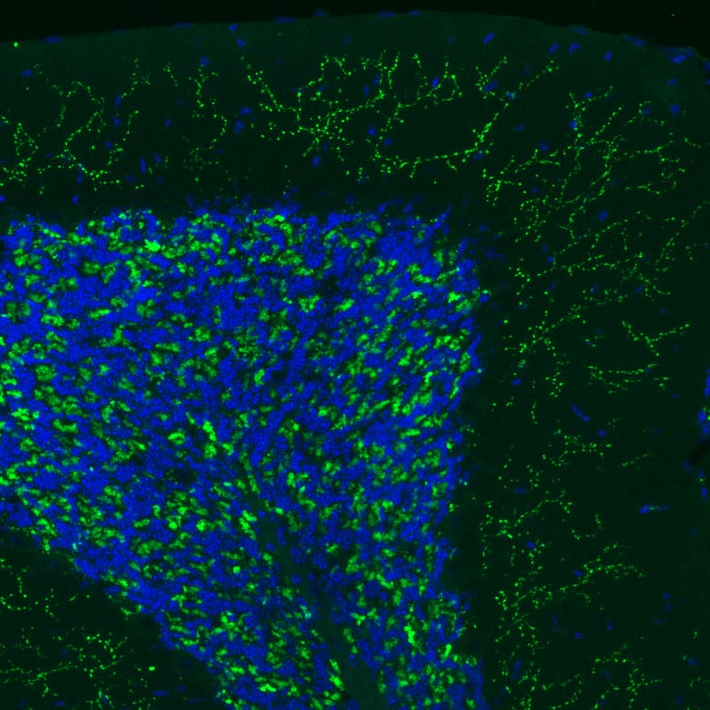 Immunohistochemistry-Paraffin: VGLUT2 Antibody (CL2921) [NBP3-52463]