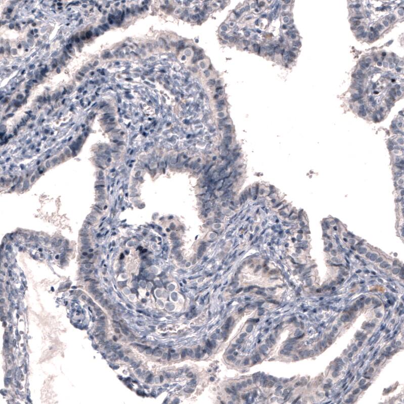 Immunohistochemistry-Paraffin: Dopa Decarboxylase/DDC Antibody (CL2962) [NBP3-52464]
