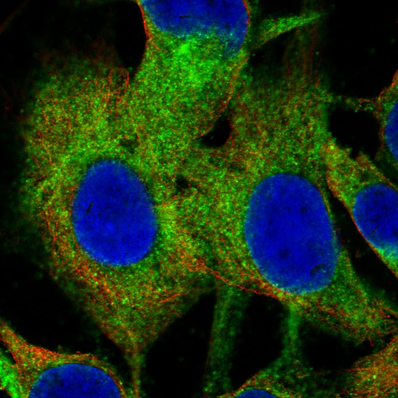 Immunocytochemistry/ Immunofluorescence: Choline Acetyltransferase/ChAT Antibody (CL3173) [NBP3-52467]