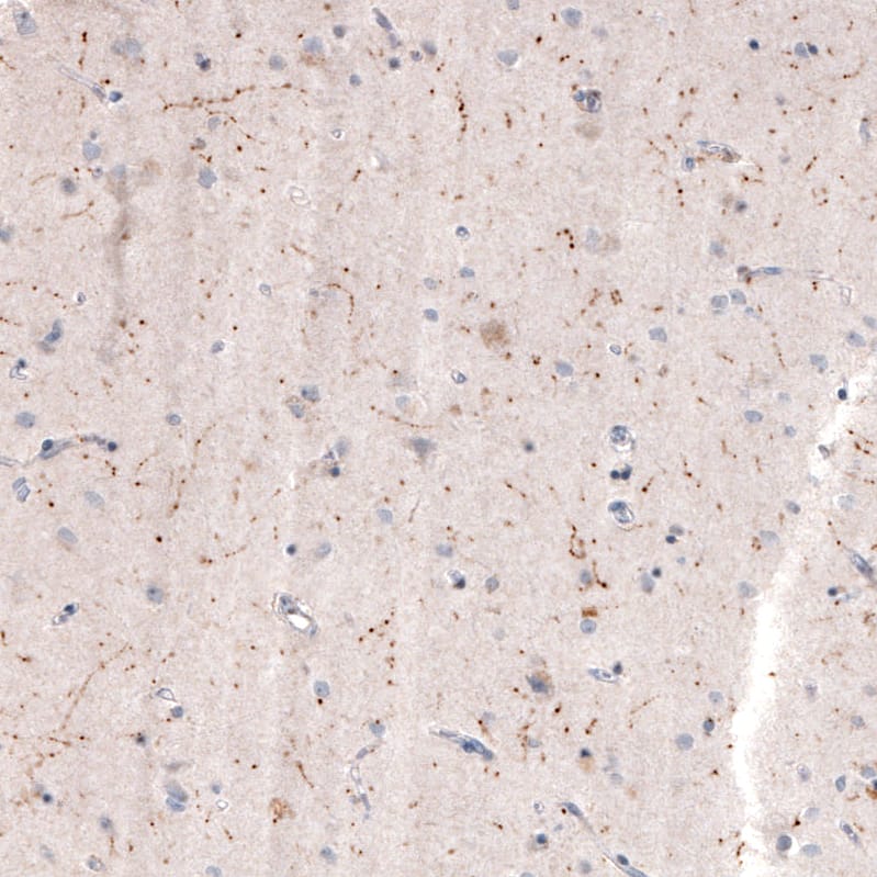 Immunohistochemistry-Paraffin: Choline Acetyltransferase/ChAT Antibody (CL3173) [NBP3-52467]