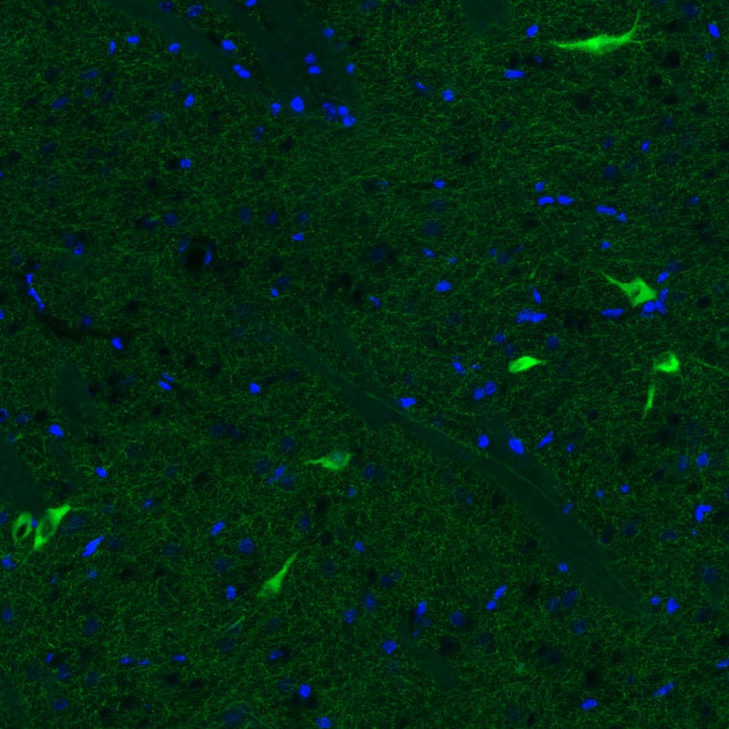 Immunohistochemistry-Paraffin: Choline Acetyltransferase/ChAT Antibody (CL3173) [NBP3-52467]