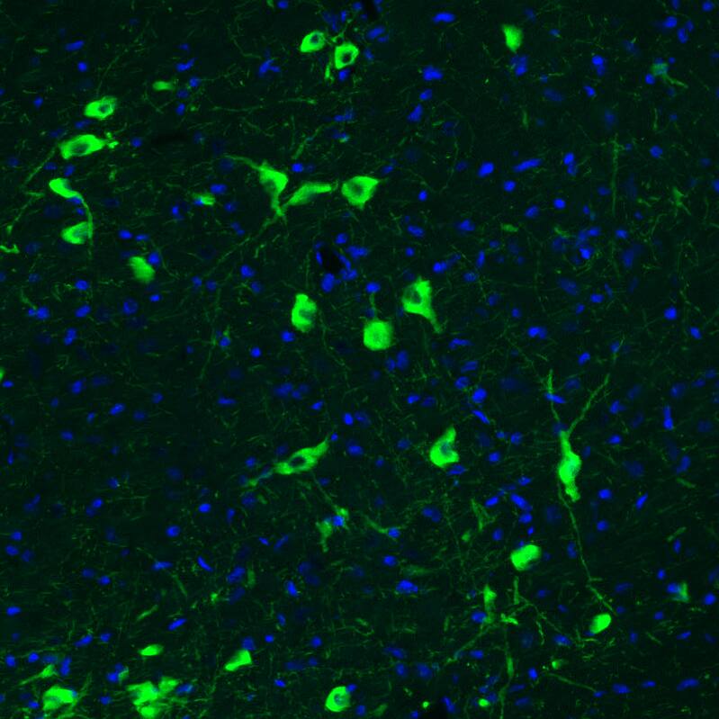 Immunohistochemistry-Paraffin: Choline Acetyltransferase/ChAT Antibody (CL3173) [NBP3-52467]