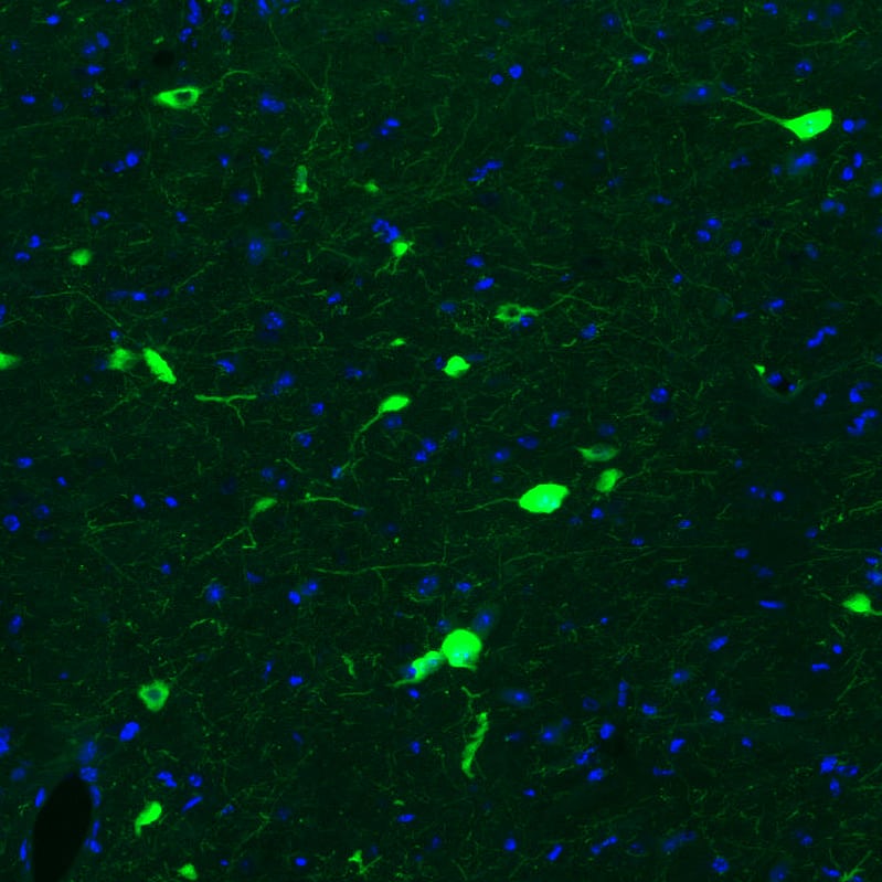 Immunohistochemistry-Paraffin: Choline Acetyltransferase/ChAT Antibody (CL3173) [NBP3-52467]