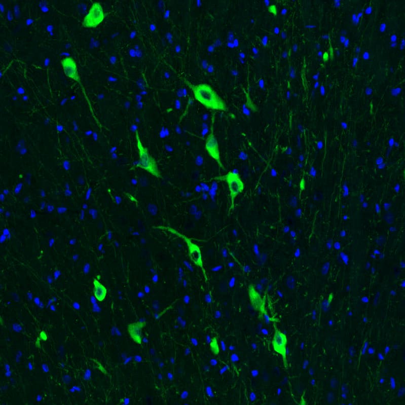 Immunohistochemistry-Paraffin: Choline Acetyltransferase/ChAT Antibody (CL3173) [NBP3-52467]