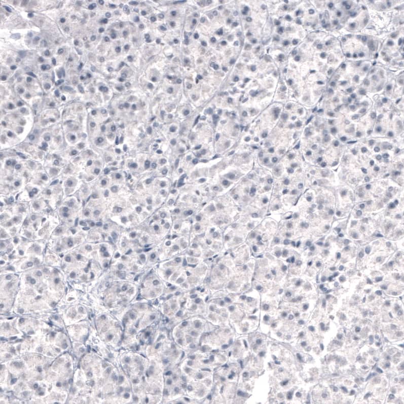 Immunohistochemistry-Paraffin: Laminin beta 3 Antibody (CL3353) [NBP3-52469]