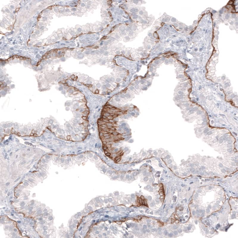 Immunohistochemistry-Paraffin: Laminin beta 3 Antibody (CL3353) [NBP3-52469]