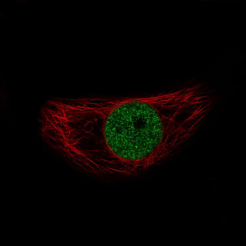 Immunocytochemistry/ Immunofluorescence: Snail Antibody (CL3700) [NBP3-52471]