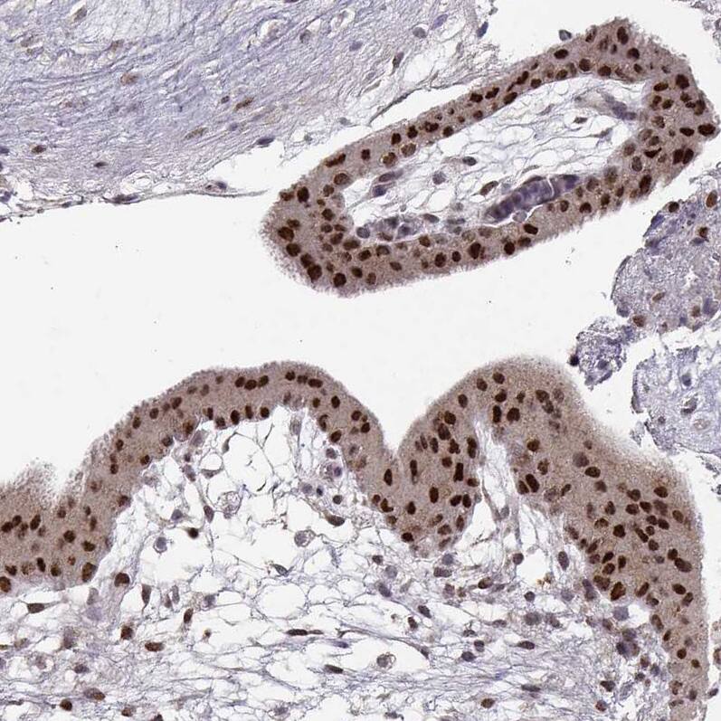 Immunohistochemistry-Paraffin: Snail Antibody (CL3700) [NBP3-52471]