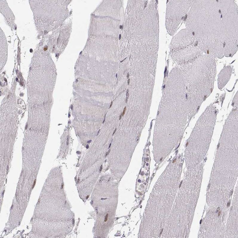 Immunohistochemistry-Paraffin: Snail Antibody (CL3700) [NBP3-52471]
