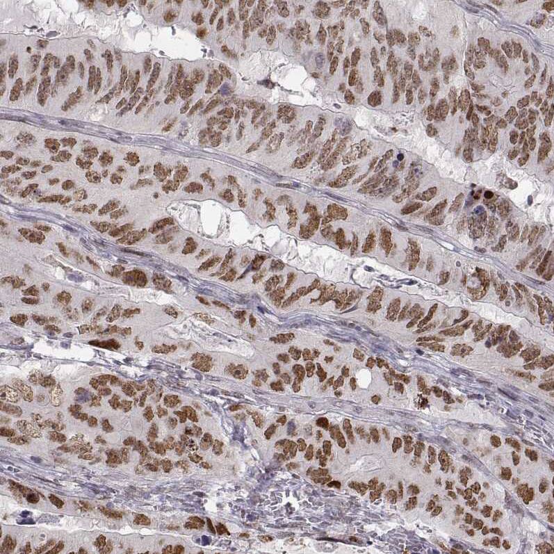 Immunohistochemistry-Paraffin: Snail Antibody (CL3700) [NBP3-52471]