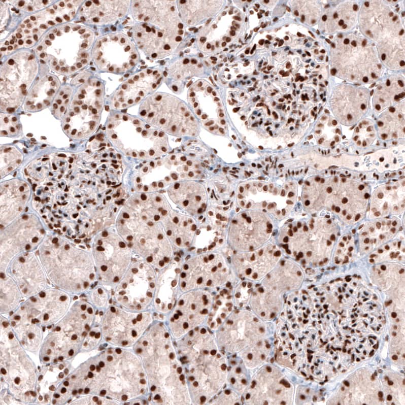 Immunohistochemistry-Paraffin: CDP/CUTL1 Antibody (CL5278) [NBP3-52477]