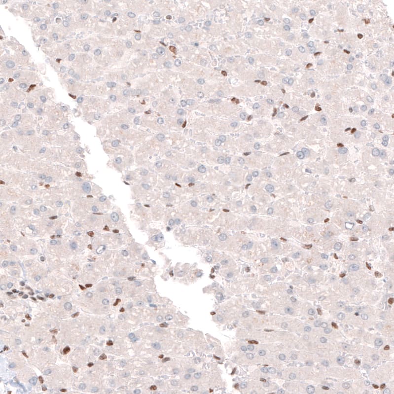 Immunohistochemistry-Paraffin: CDP/CUTL1 Antibody (CL5278) [NBP3-52477]