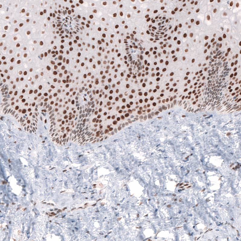 Immunohistochemistry-Paraffin: CDP/CUTL1 Antibody (CL5278) [NBP3-52477]