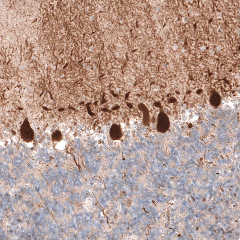 Immunohistochemistry-Paraffin: PCP4 Antibody (CL5306) [NBP3-52479]