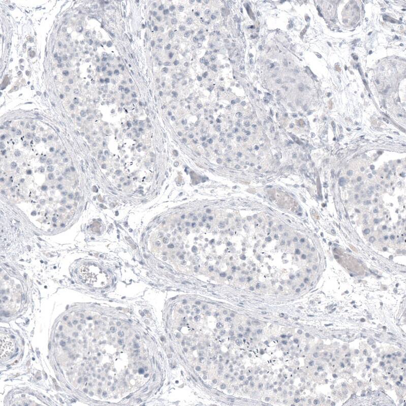 Immunohistochemistry-Paraffin: PCP4 Antibody (CL5306) [NBP3-52479]