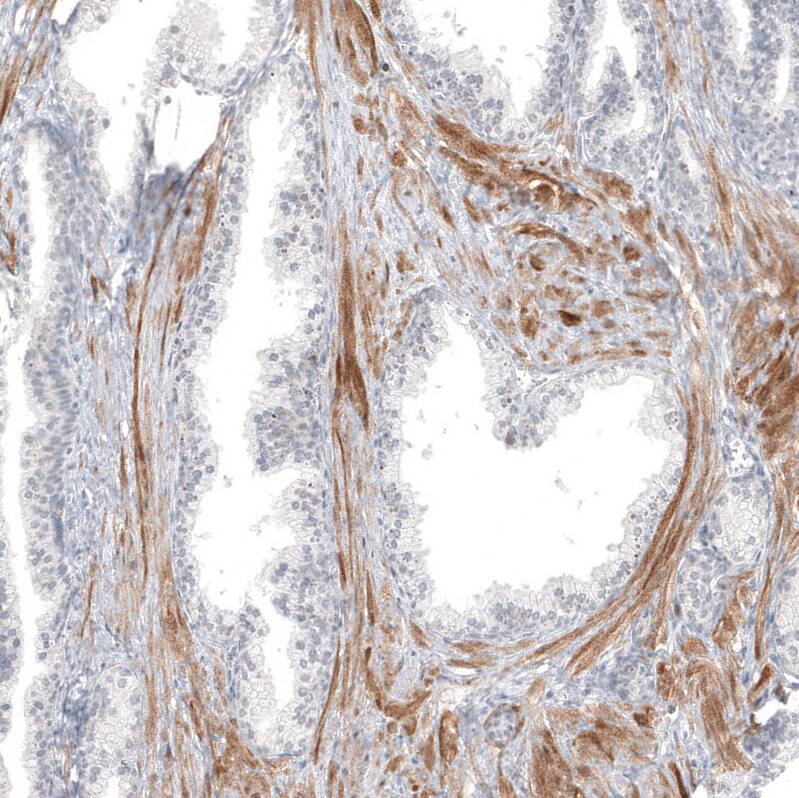 Immunohistochemistry-Paraffin: PCP4 Antibody (CL5306) [NBP3-52479]