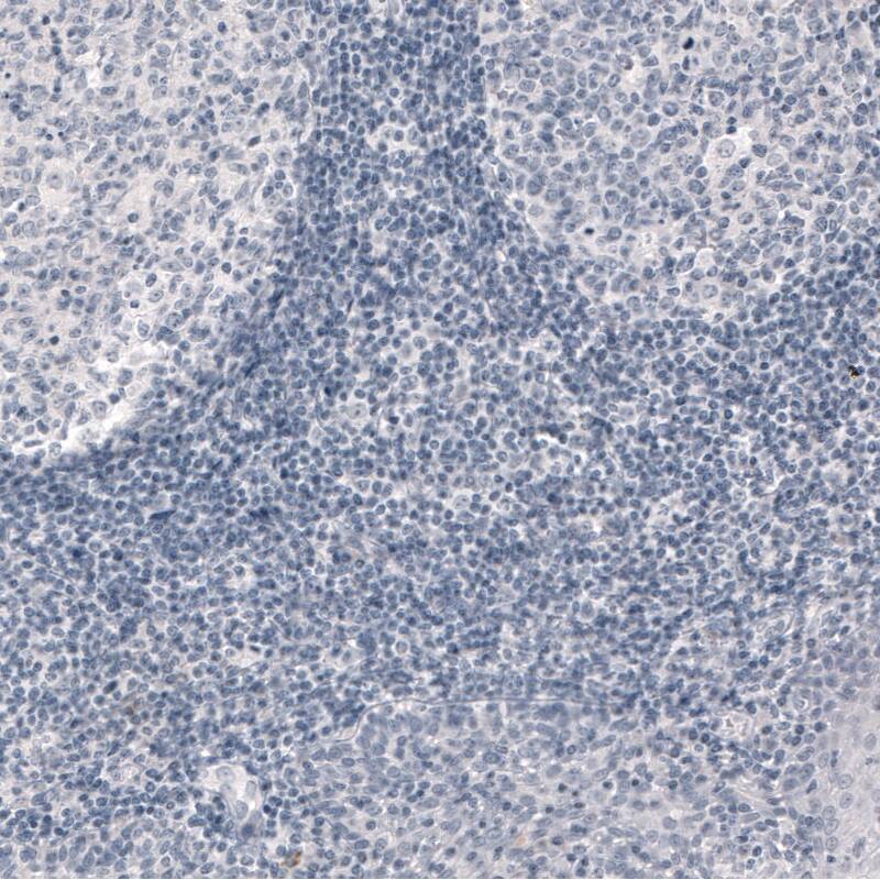 Immunohistochemistry-Paraffin: PCP4 Antibody (CL5306) [NBP3-52479]
