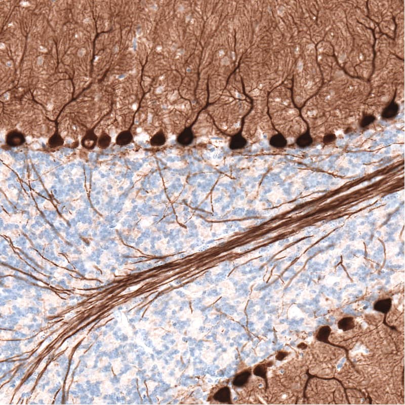 Immunohistochemistry-Paraffin: PCP4 Antibody (CL5306) [NBP3-52479]