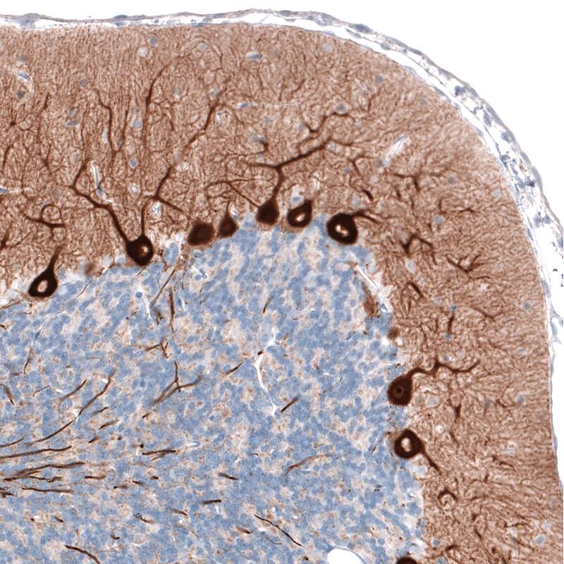 Immunohistochemistry-Paraffin: PCP4 Antibody (CL5306) [NBP3-52479]