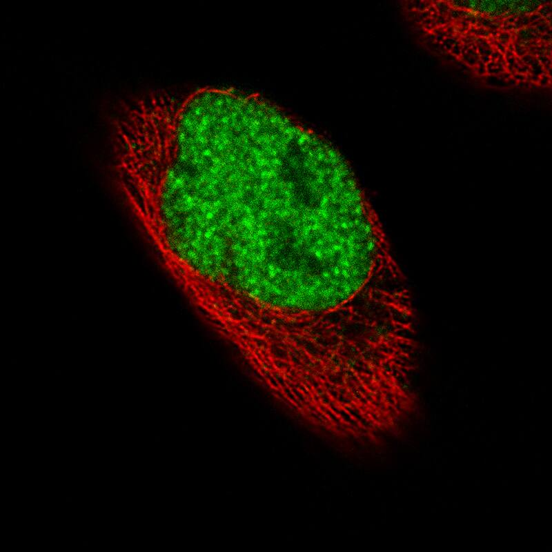 Immunocytochemistry/ Immunofluorescence: FoxP2 Antibody (CL5312) [NBP3-52480]