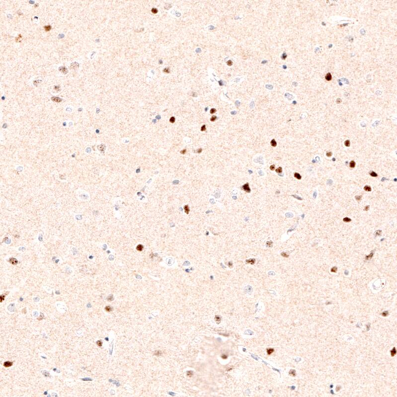 Immunohistochemistry-Paraffin: FoxP2 Antibody (CL5312) [NBP3-52480]