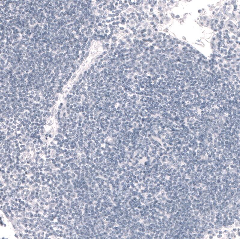 Immunohistochemistry-Paraffin: FoxP2 Antibody (CL5312) [NBP3-52480]
