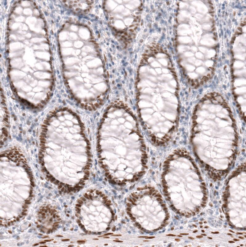 Immunohistochemistry-Paraffin: FoxP2 Antibody (CL5312) [NBP3-52480]