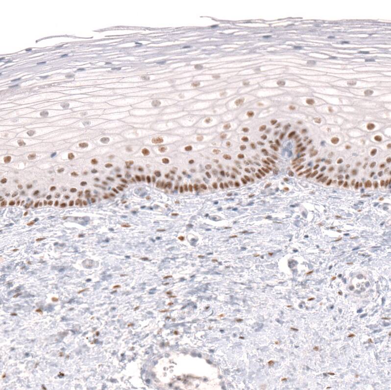 Immunohistochemistry-Paraffin: FoxP2 Antibody (CL5312) [NBP3-52480]