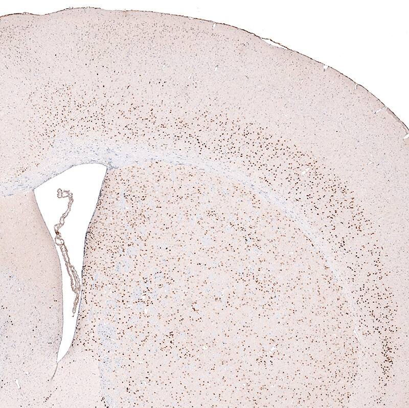 Immunohistochemistry-Paraffin: FoxP2 Antibody (CL5312) [NBP3-52480]
