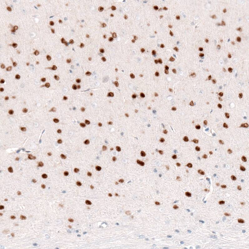 Immunohistochemistry-Paraffin: FoxP2 Antibody (CL5312) [NBP3-52480]