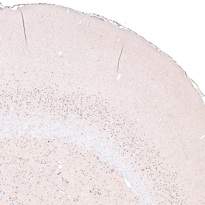 Immunohistochemistry-Paraffin: FoxP2 Antibody (CL5312) [NBP3-52480]