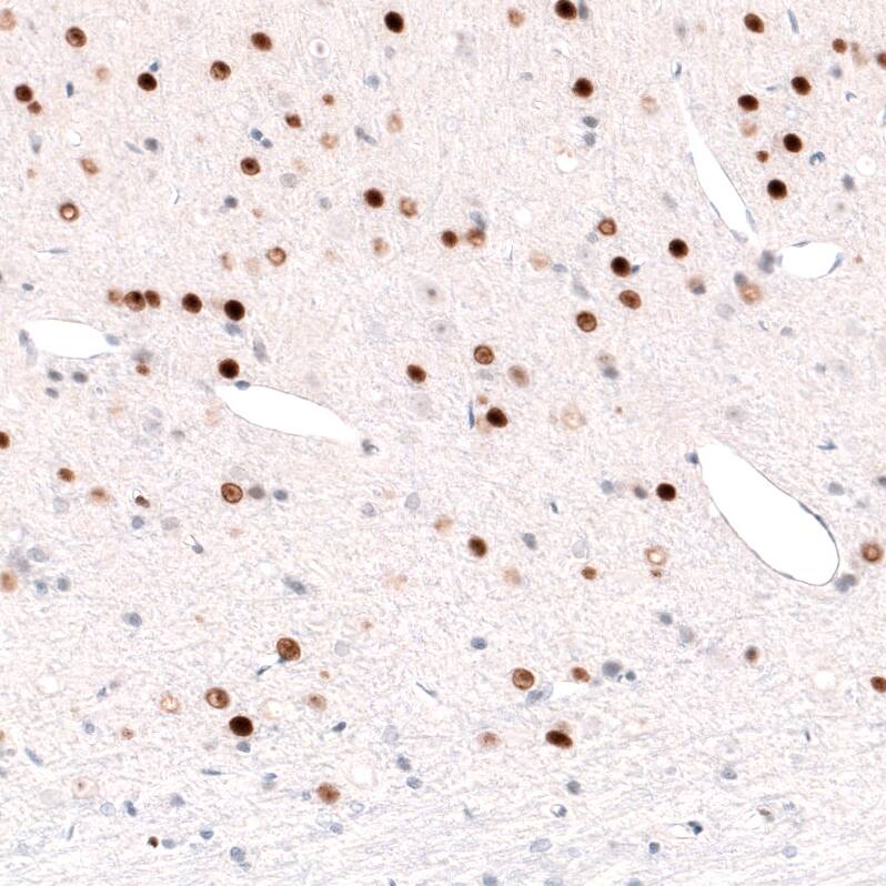 Immunohistochemistry-Paraffin: FoxP2 Antibody (CL5312) [NBP3-52480]