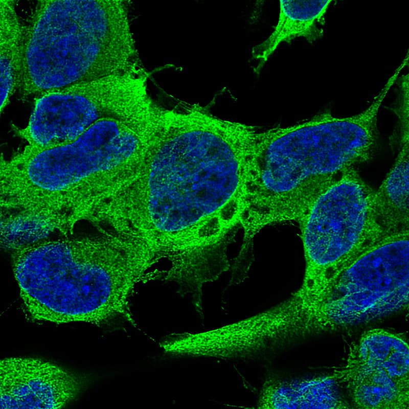 Immunocytochemistry/ Immunofluorescence: beta-III Tubulin Antibody (CL5813) [NBP3-52481]