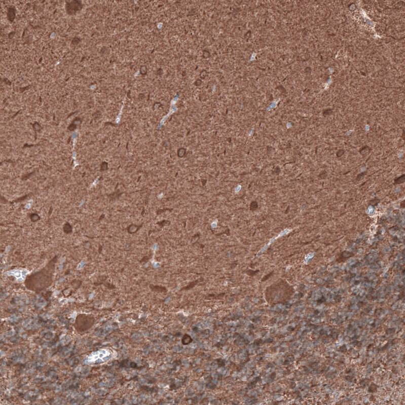 beta-III Tubulin Antibody (CL5813) Immunohistochemistry: beta-III Tubulin Antibody (CL5813) [NBP3-52481]