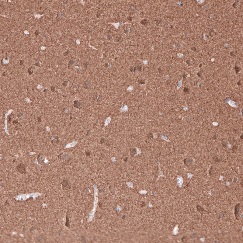 Immunohistochemistry-Paraffin: beta-III Tubulin Antibody (CL5813) [NBP3-52481]