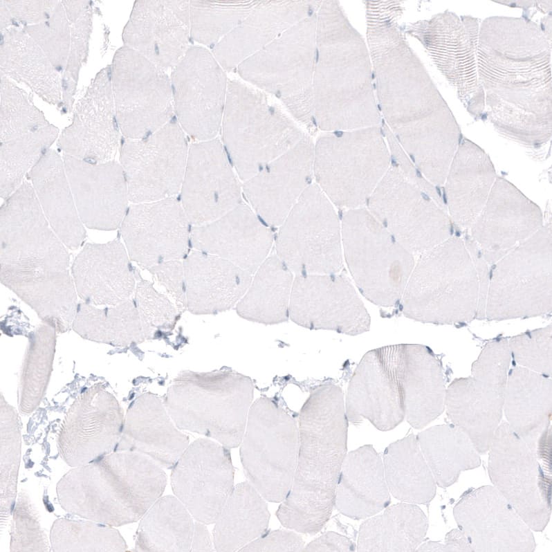 Immunohistochemistry-Paraffin: beta-III Tubulin Antibody (CL5813) [NBP3-52481]