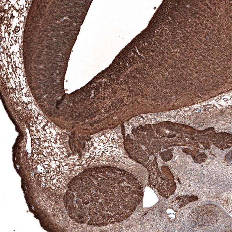 Immunohistochemistry-Paraffin: beta-III Tubulin Antibody (CL5813) [NBP3-52481]