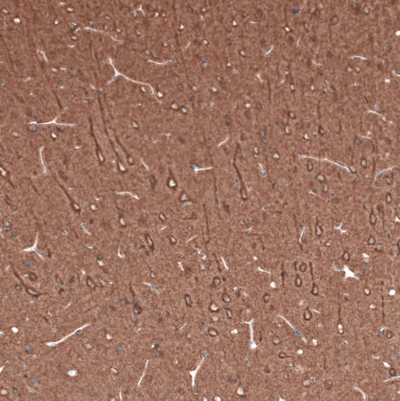 Immunohistochemistry-Paraffin: beta-III Tubulin Antibody (CL5813) [NBP3-52481]