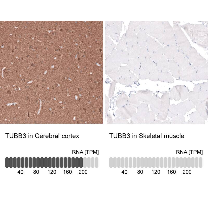 Immunohistochemistry-Paraffin: beta-III Tubulin Antibody (CL5813) [NBP3-52481]